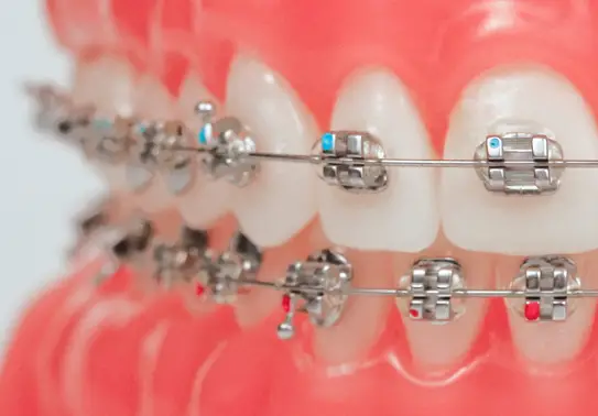 Dentist Who Accept Medicaid For Braces