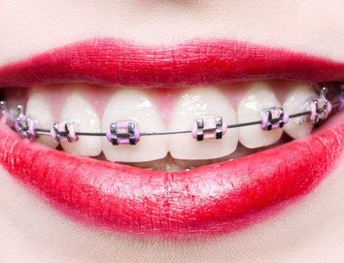 Affordable braces for the entire family. Insurances ...