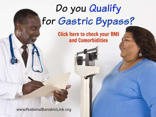 GASTRIC BYPASS SURGERY: Qualifying for Gastric Bypass ...