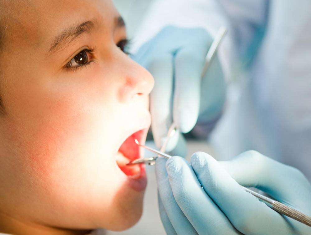 Does Medicaid Cover Dental? (with pictures)