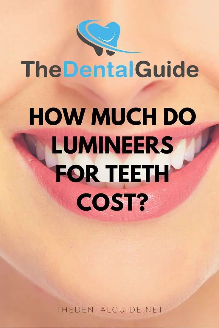 How Much do Lumineers for Teeth Cost?