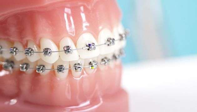 Dental Offices That Accept Medicaid For Braces