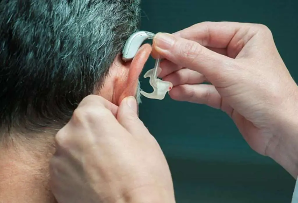What Does Medicare Cover for Hearing Loss