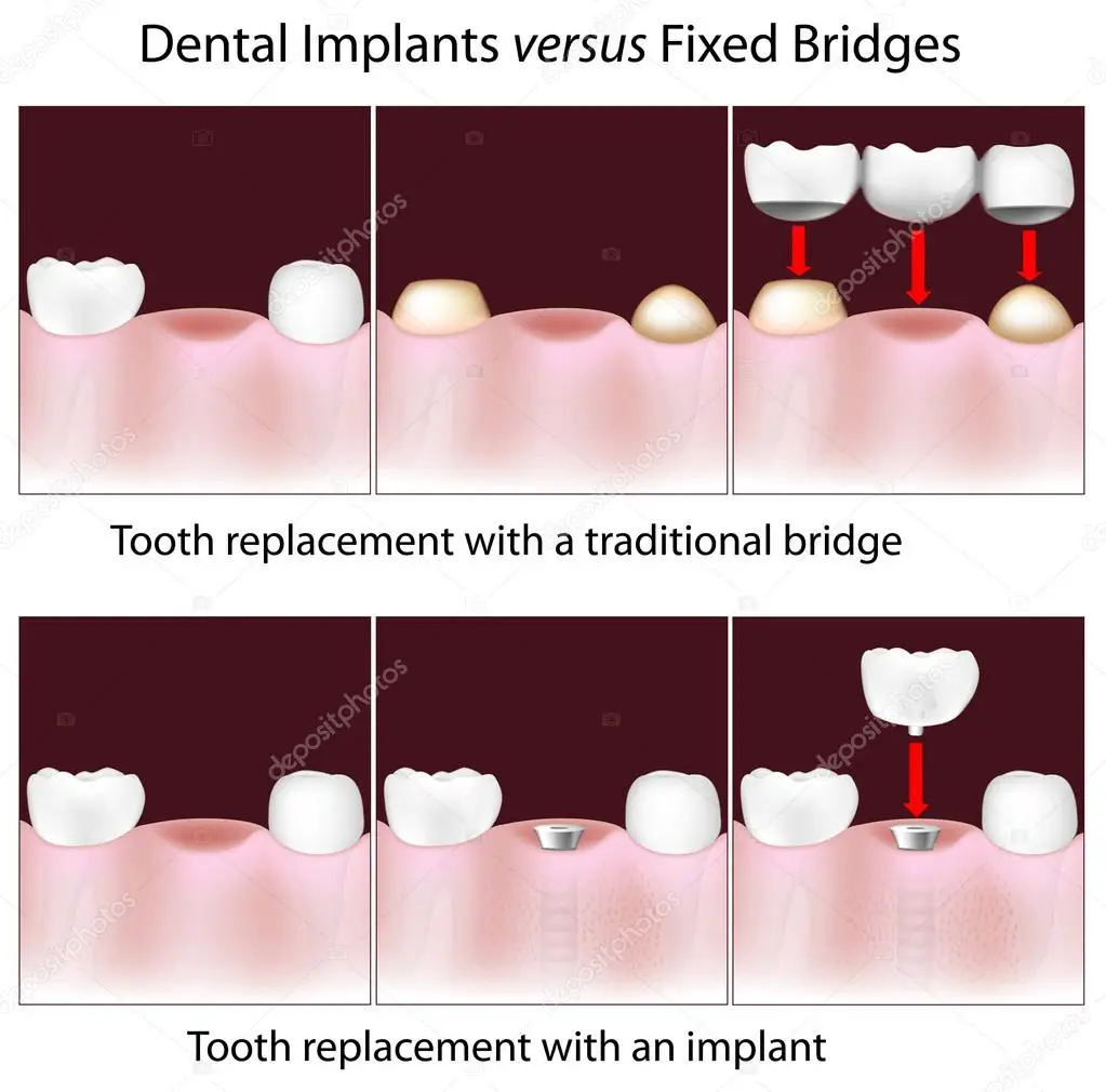 Dentists: Medicaid Implant Free Dentists Columbus Ohio