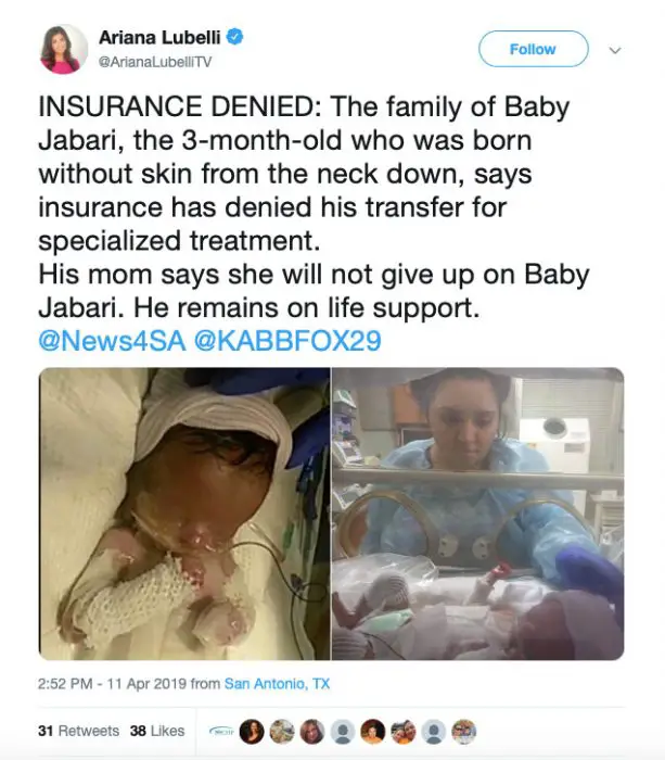 After public outcry, Medicaid allows baby born without skin to be ...